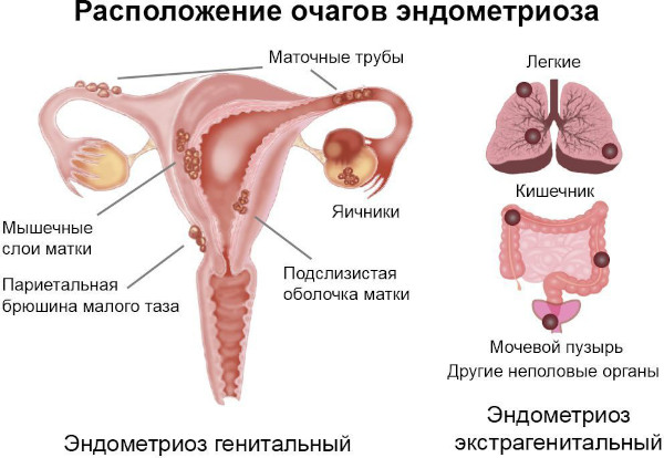 Гемолакрия что это за болезнь, причины, лечение