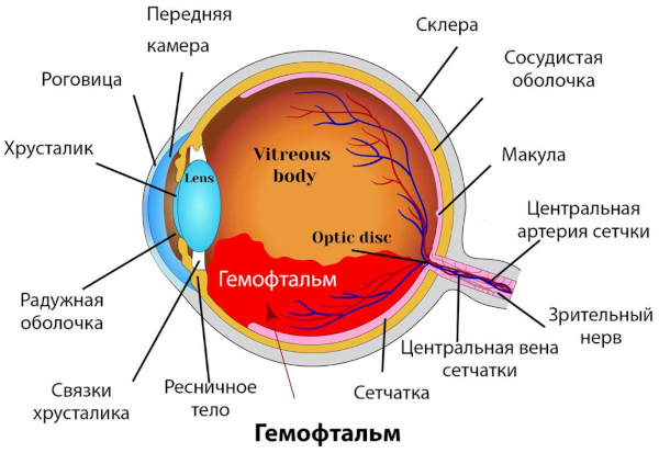 Гемолакрия что это за болезнь, причины, лечение