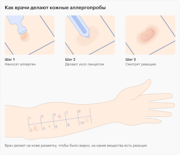 Гордокс (Gordox) ампулы. Инструкция по применению, цена, отзывы