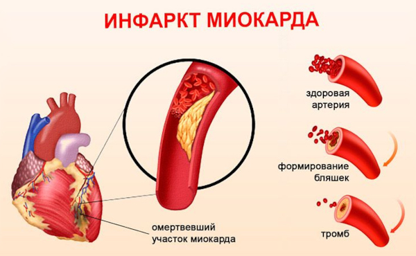 Гордокс (Gordox) ампулы. Инструкция по применению, цена, отзывы