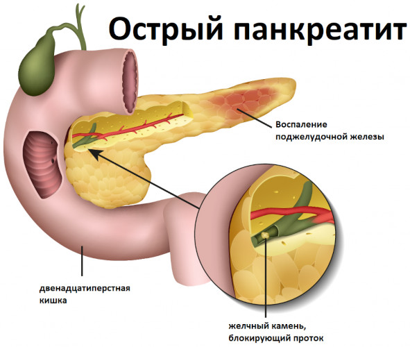 Гордокс (Gordox) ампулы. Инструкция по применению, цена, отзывы