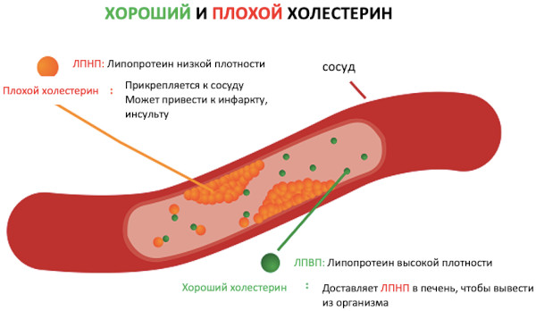 Нарушение липидного обмена. Что это такое, как лечить