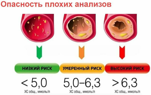 Нарушение липидного обмена. Что это такое, как лечить