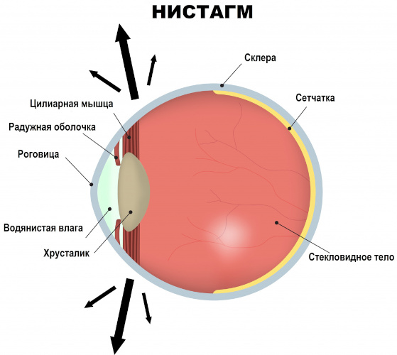 Нистагм глаз. Что это такое у взрослых, причины