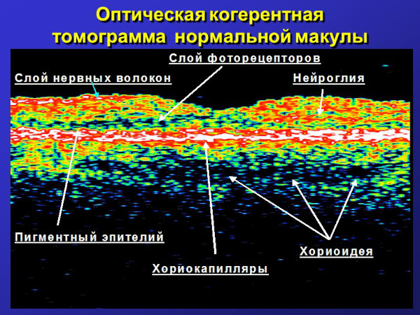 Оптическая когерентная томография глаза. Что это такое