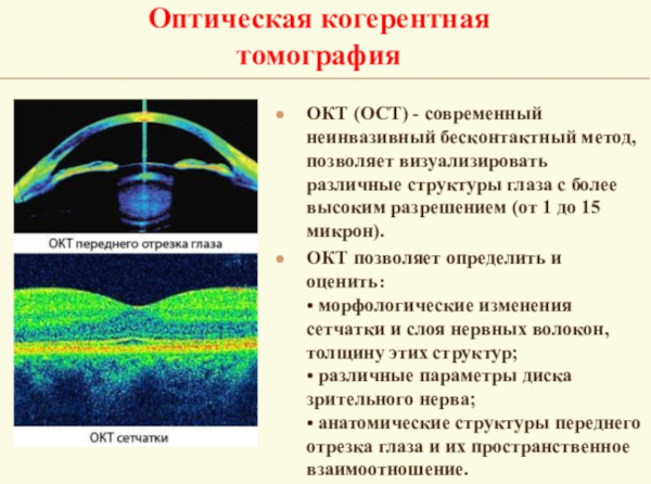 Оптическая когерентная томография глаза. Что это такое