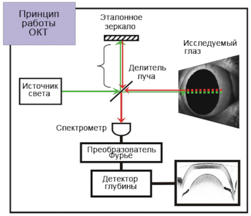 Оптическая когерентная томография глаза. Что это такое