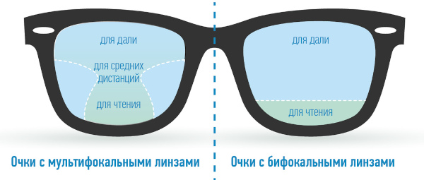 Пресбиопия глаз. Что это такое у взрослых, как лечить