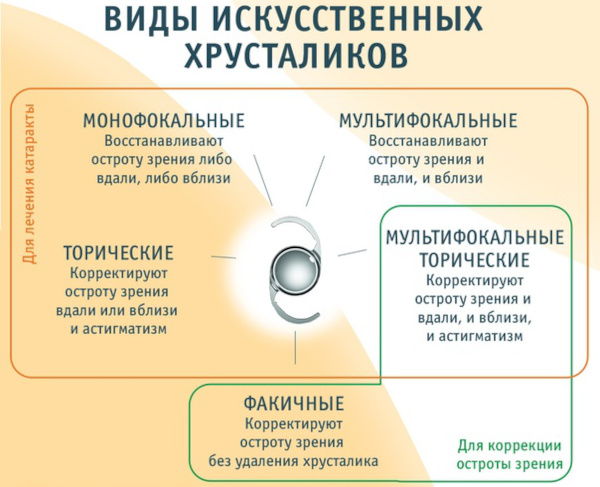 Пресбиопия глаз. Что это такое у взрослых, как лечить