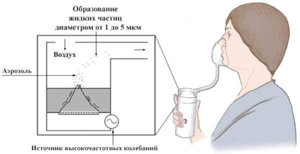 Респираторный микоплазмоз у взрослых. Симптомы, лечение