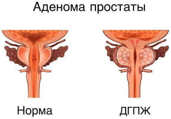 Сетегис (Setegis). Инструкция по применению, цена, отзывы