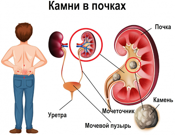 Теразозин (Terazosin) таблетки. Инструкция по применению, цена