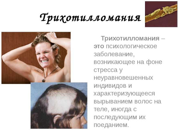 Трихобезоар желудка. Что это такое, симптомы, лечение