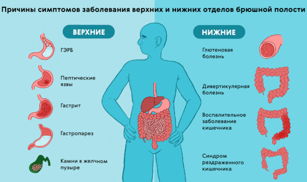 Вертигохель (Vertigoheel). Инструкция по применению, цена, отзывы