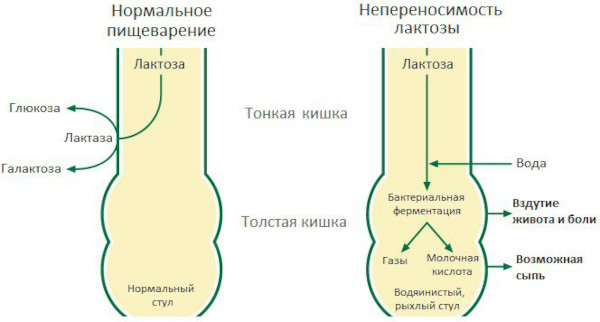 Вертигохель (Vertigoheel). Инструкция по применению, цена, отзывы