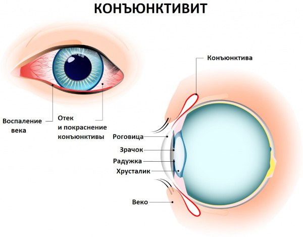 Визаллергол (Vizallergol) глазные капли. Инструкция по применению, цена