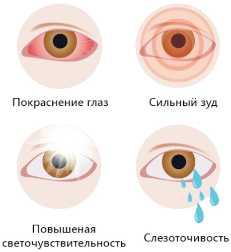 Визаллергол (Vizallergol) глазные капли. Инструкция по применению, цена