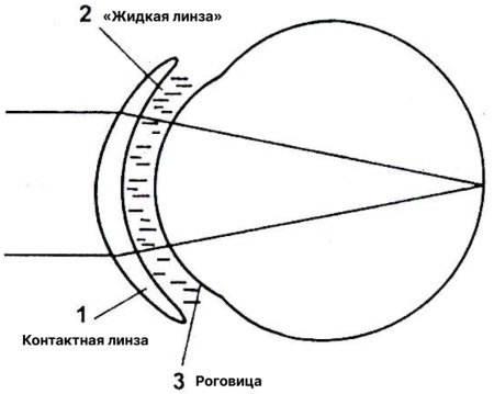 Подбор контактных линз. Как правильно выбрать лучшие