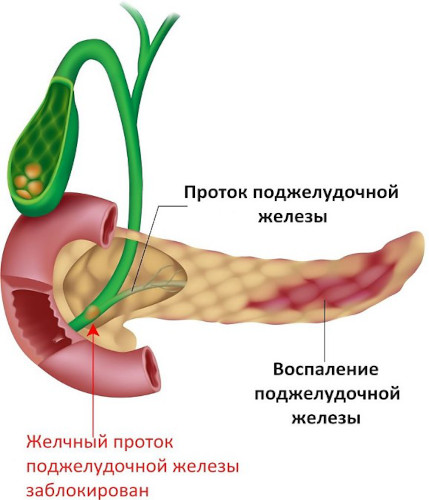 Семя льна при запорах. Как принимать взрослым, инструкция