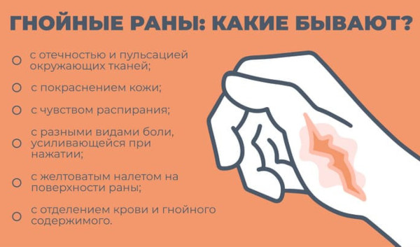 Антибиотики при гнойных ранах у взрослых в таблетках. Список