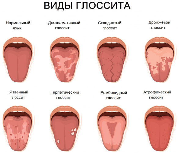 Антибиотики тетрациклинового ряда. Список для человека