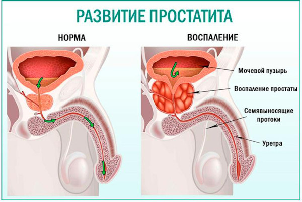 Антибиотики тетрациклинового ряда. Список для человека