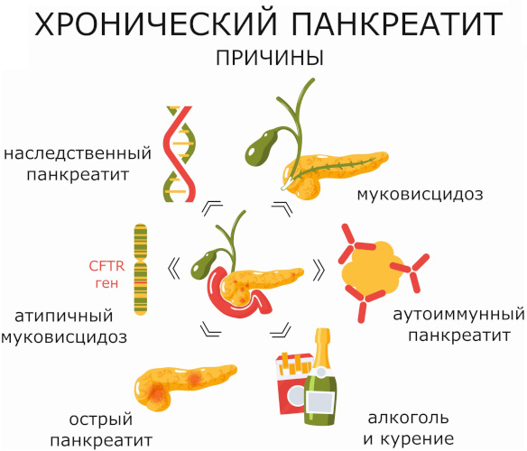 Аутоиммунный панкреатит. Симптомы, клинические рекомендации