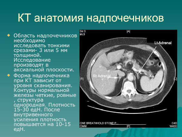 Болезнь Аддисона (бронзовая). Что это такое, симптомы