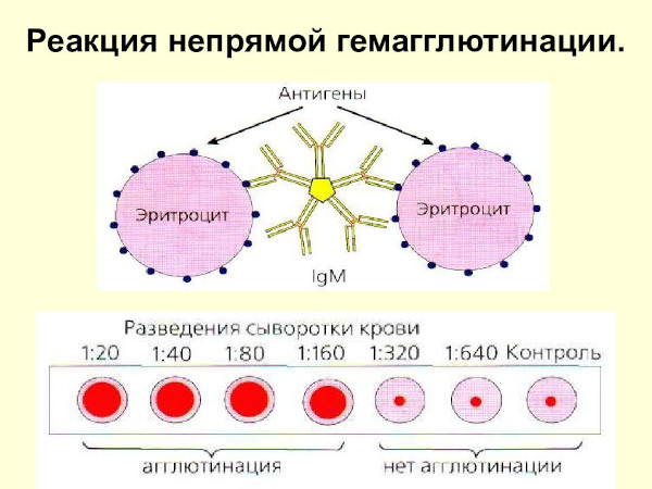 Брюшной тиф. Симптомы у детей, лечение