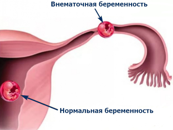 Что у человека в левом боку ниже ребер, что может болеть