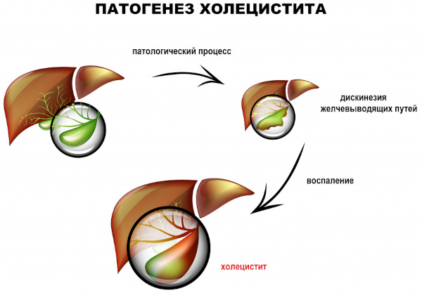 Детокс. Это что такое простыми словами в питании