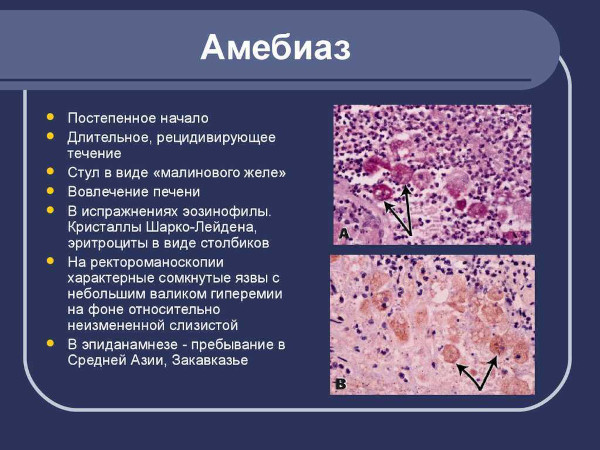 Дизентерия у детей. Что это такое, симптомы, лечение