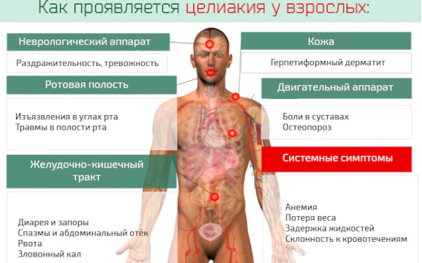 Глютеновая энтеропатия. Клинические рекомендации