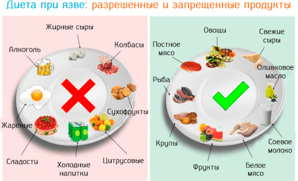 Меню при язве желудка на неделю на каждый день с рецептами