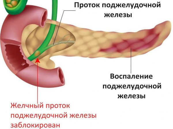 Облепиховое масло в капсулах. Инструкция по применению, цена