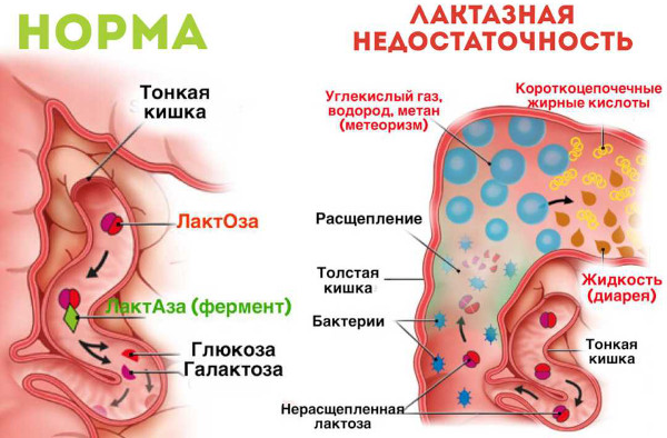 Ондансетрон таблетки. Инструкция по применению, цена