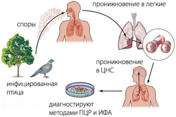 Орнитоз это что за болезнь. Симптомы, лечение