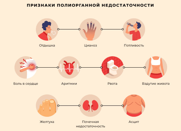 Синдром Гудпасчера это что такое. Диагностика, симптомы