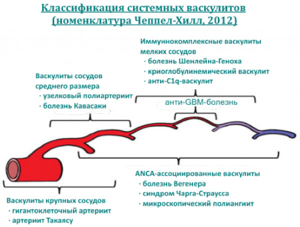 Системные васкулиты. Классификация, клинические рекомендации