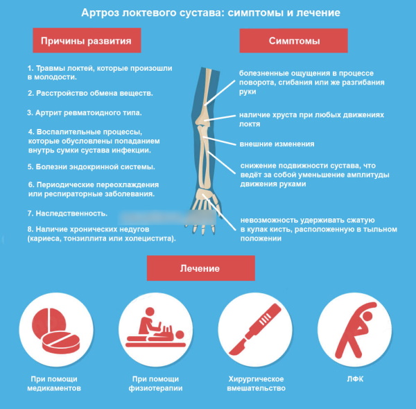 Остеоартроз локтевого сустава у женщин. Что это, лечение
