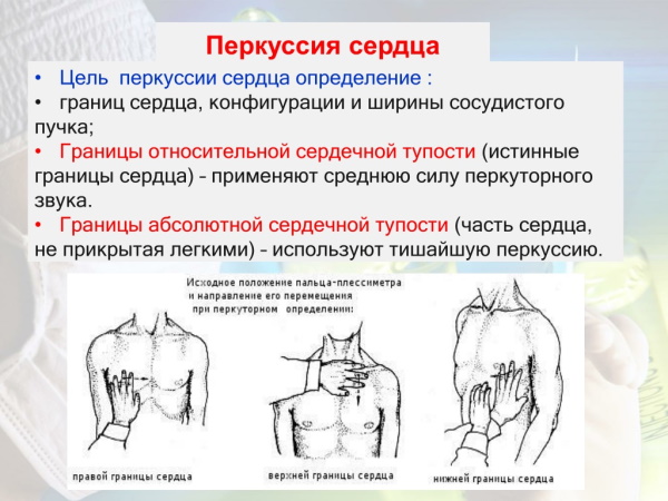 Синдром Дресслера при инфаркте миокарда. Лечение