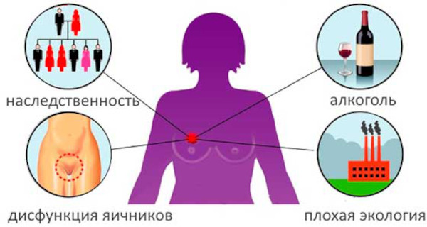 Аденоз молочной железы. Что это, УЗИ, лечение