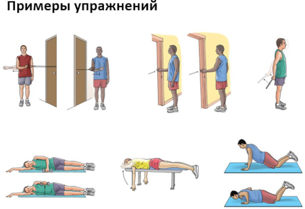 Адгезивный капсулит плечевого сустава. Что это, лечение