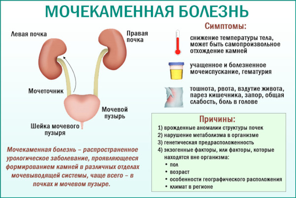 Боли в почках. Причины у женщин, лечение после 50 лет