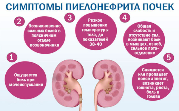 Боли в почках. Причины у женщин, лечение после 50 лет