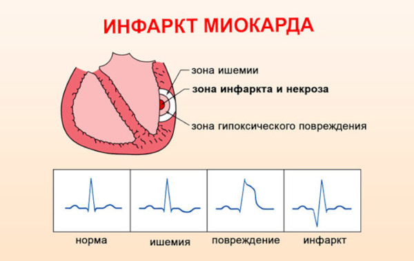 Клофелин (Clophelin) таблетки. Инструкция по применению