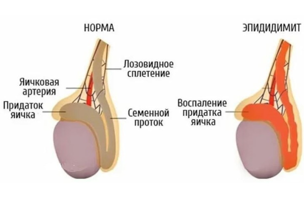 Урологические заболевания у мужчин. Симптомы и лечение болезней