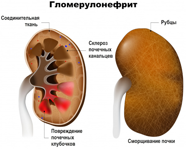 Гепарин (Heparin) уколы. Инструкция по применению, цена