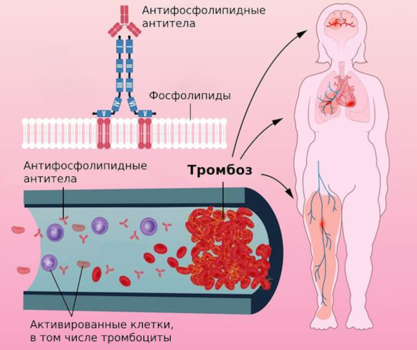 Гепарин (Heparin) уколы. Инструкция по применению, цена