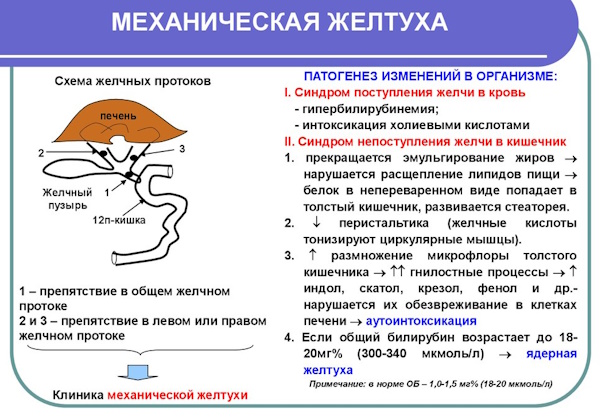 Механическая желтуха что это такое. Клинические рекомендации